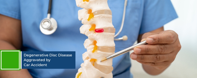 Degenerative Disc Disease Aggravated by Car Accident
